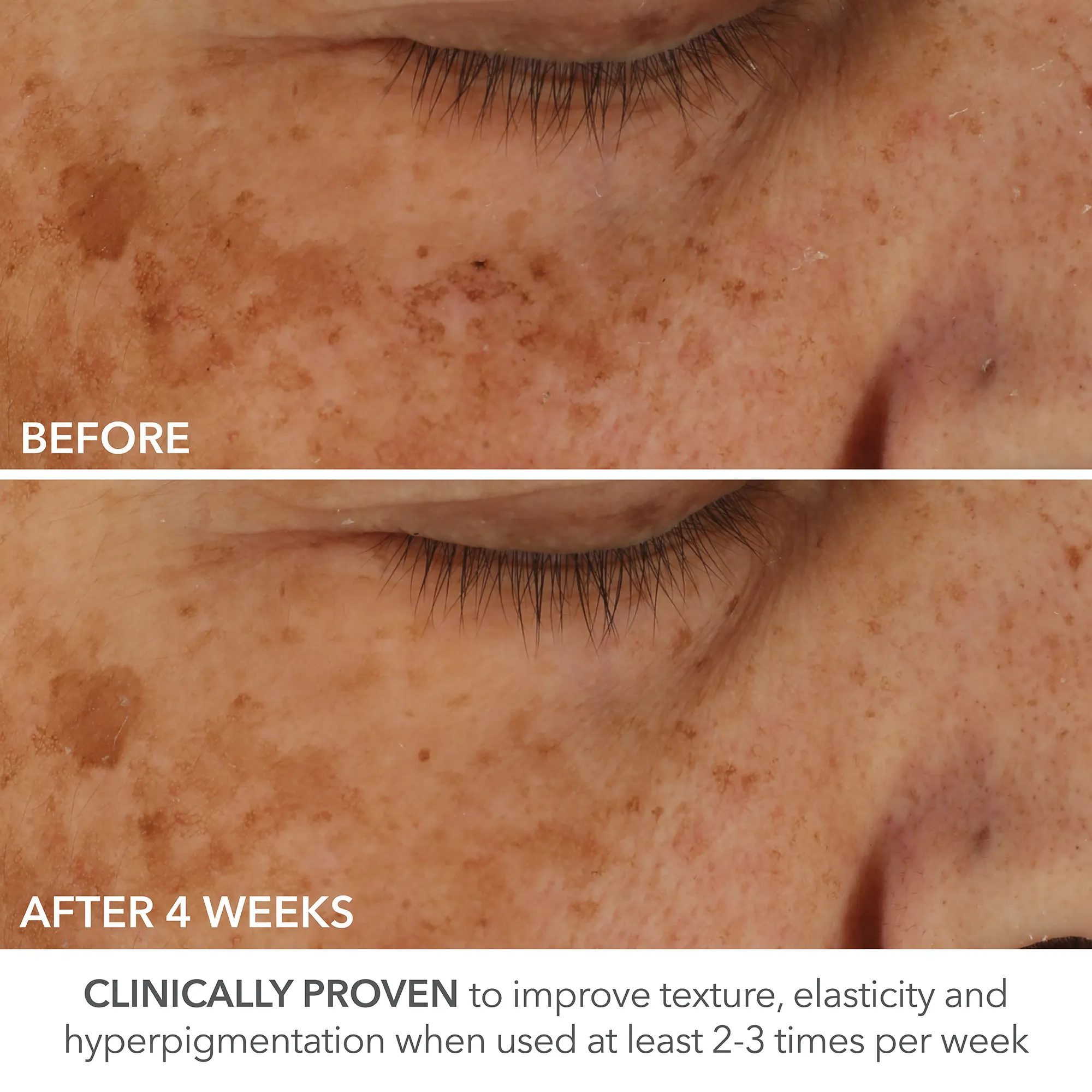 Dr Dennis Gross Skincare Advanced Retinol + Ferulic Perfectly Dosed Retinol Universal 0.2% 16 Dr Dennis Gross Skincare Advanced Retinol + Ferulic Perfectly Dosed Retinol Universal 0.2%