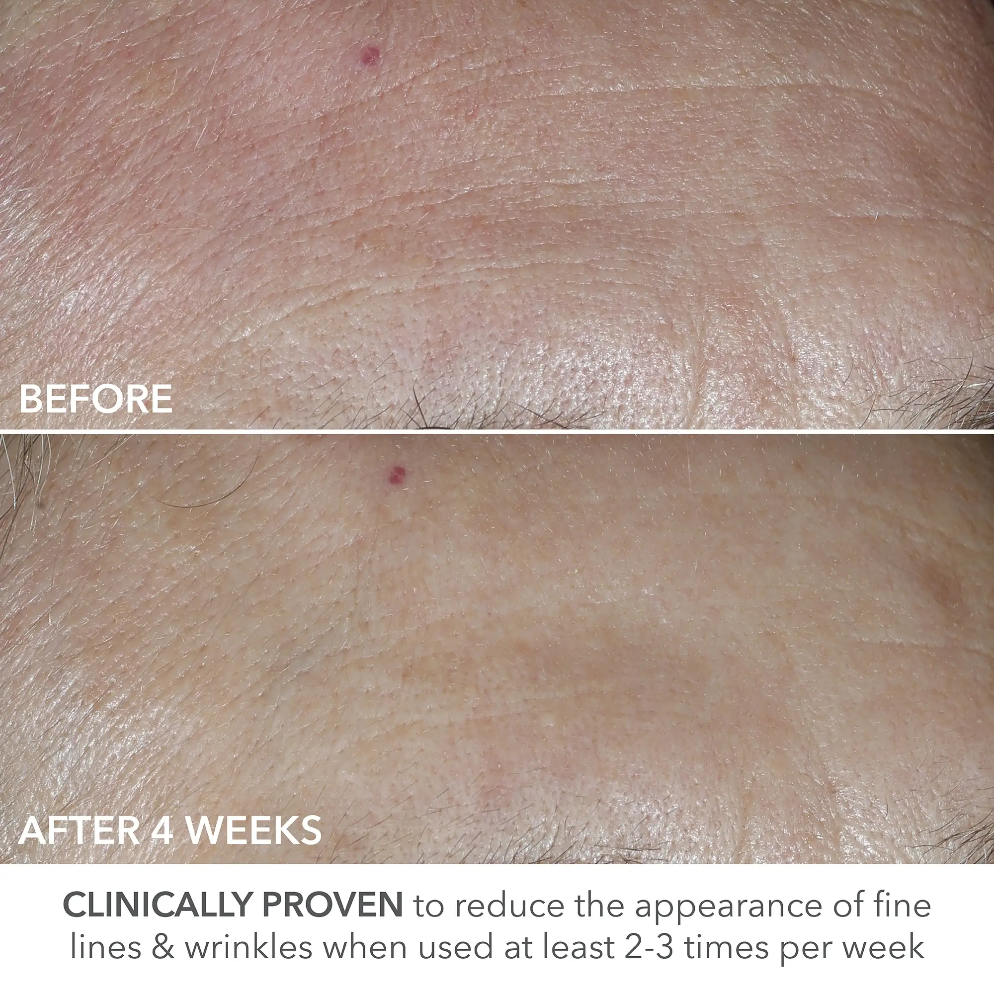 Dr Dennis Gross Skincare Advanced Retinol + Ferulic Perfectly Dosed Retinol Universal 0.2% 19 Dr Dennis Gross Skincare Advanced Retinol + Ferulic Perfectly Dosed Retinol Universal 0.2%