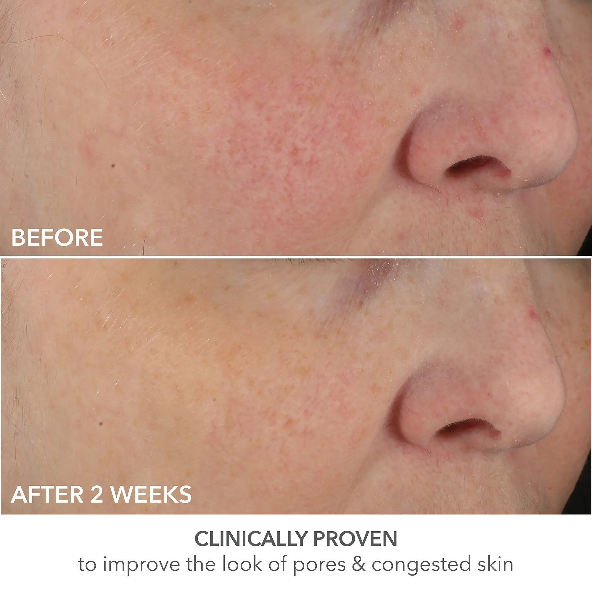 Dr Dennis Gross Skincare Advanced Retinol + Ferulic Perfectly Dosed Retinol Universal 0.2% 20 Dr Dennis Gross Skincare Advanced Retinol + Ferulic Perfectly Dosed Retinol Universal 0.2%