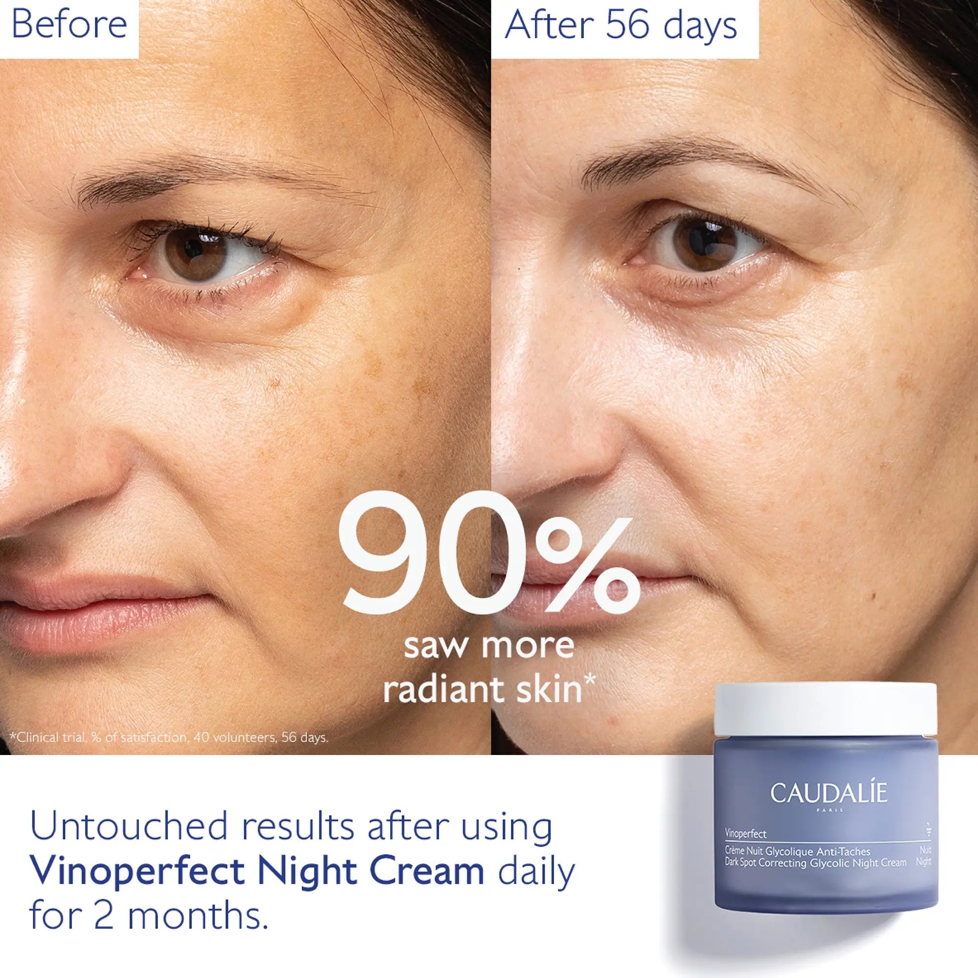 Caudalie Vinoperfect Dark Spot Correcting Glycolic Night Cream 50ml 11 Caudalie Vinoperfect Dark Spot Correcting Glycolic Night Cream 50ml