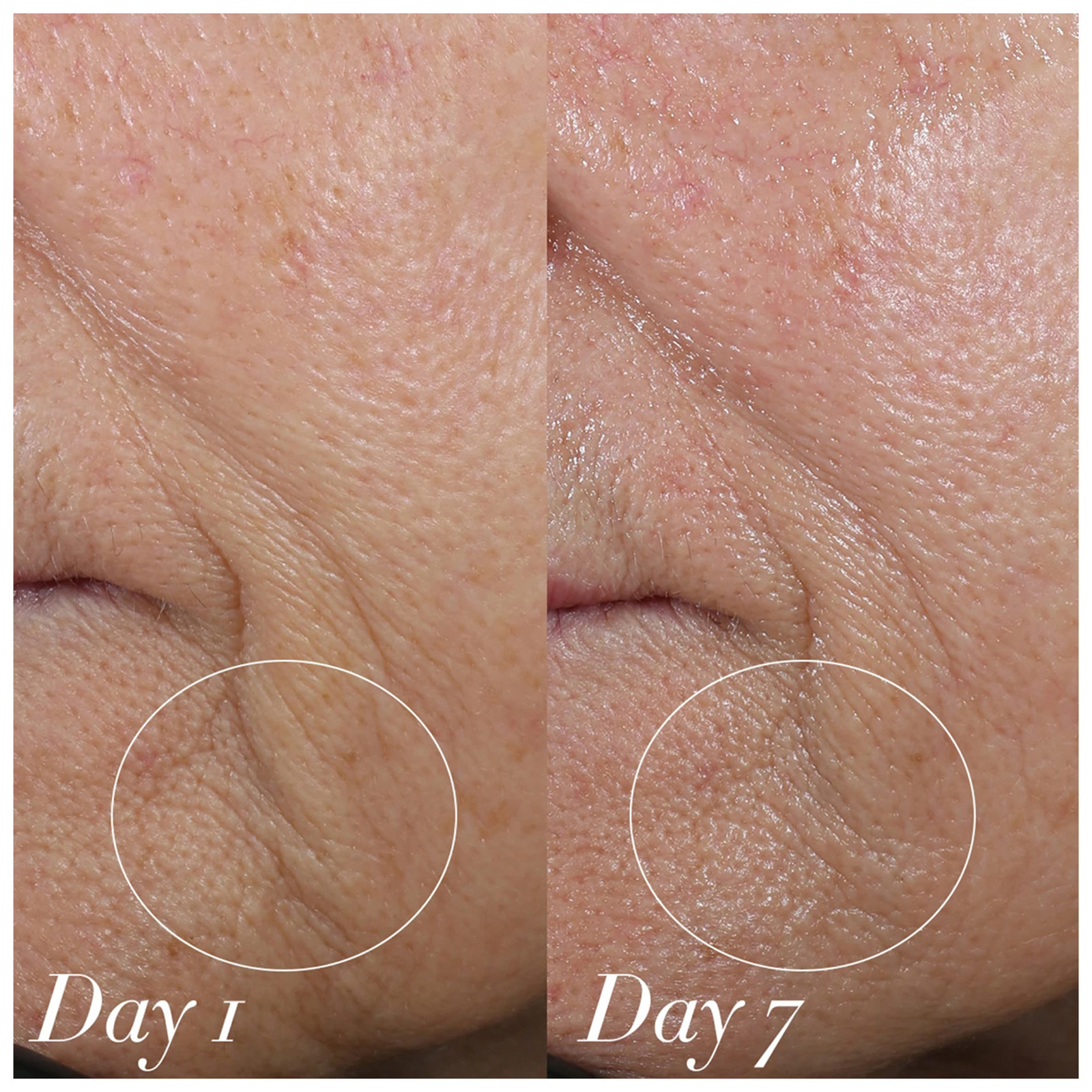 Shani Darden Skin Care Facial Sculpting Wand 10 Shani Darden Skin Care Facial Sculpting Wand